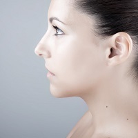 Chin Augmentation