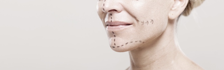 Chin Augmentation