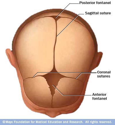 Craniosynostosis