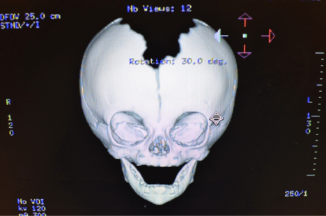 Syndromes Treated